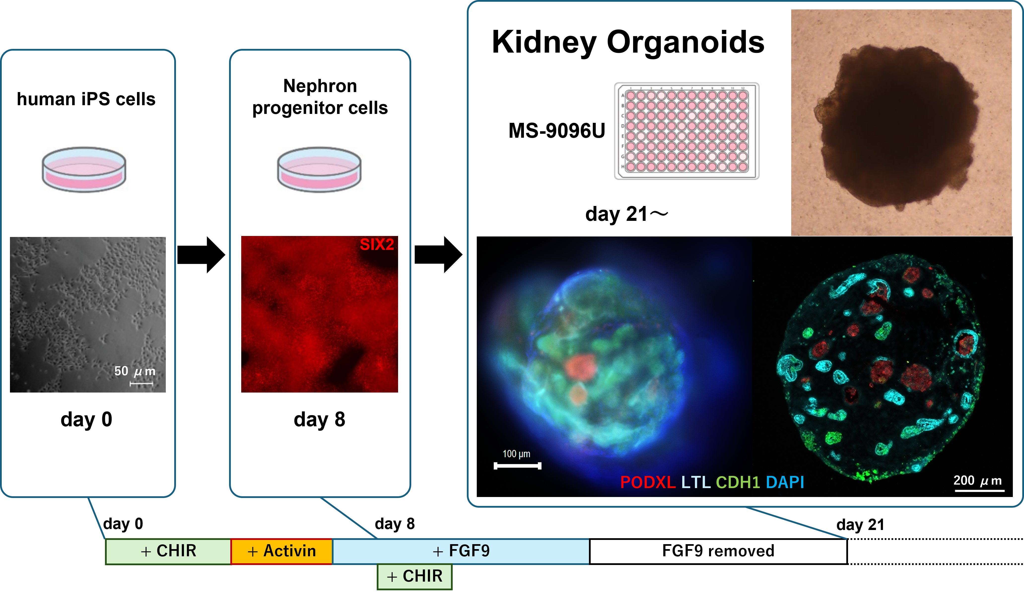 Kidney Organoids