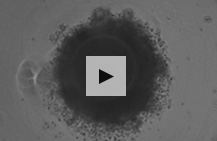 Time-lapse imaging of human iPS cells spheroid (embryoid body) formation