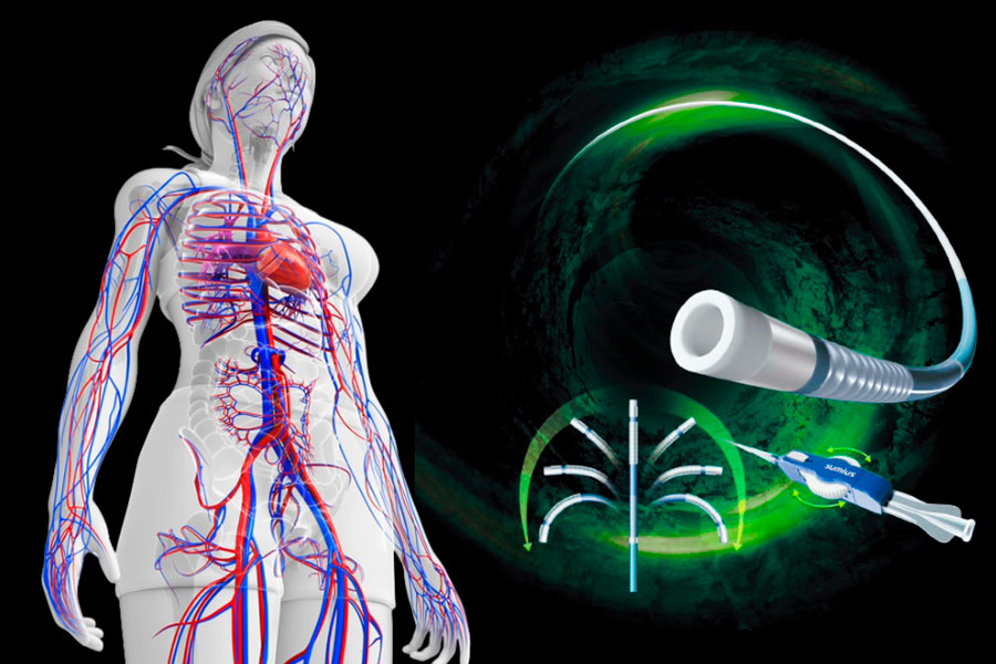 Device Name: SwiftNINJA&trade; Steerable Microcatheter