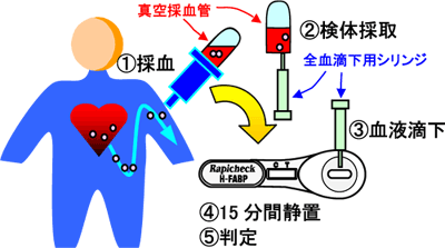 操作法（略図）