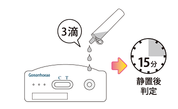 検査方法、女性生殖器からの検体、手順