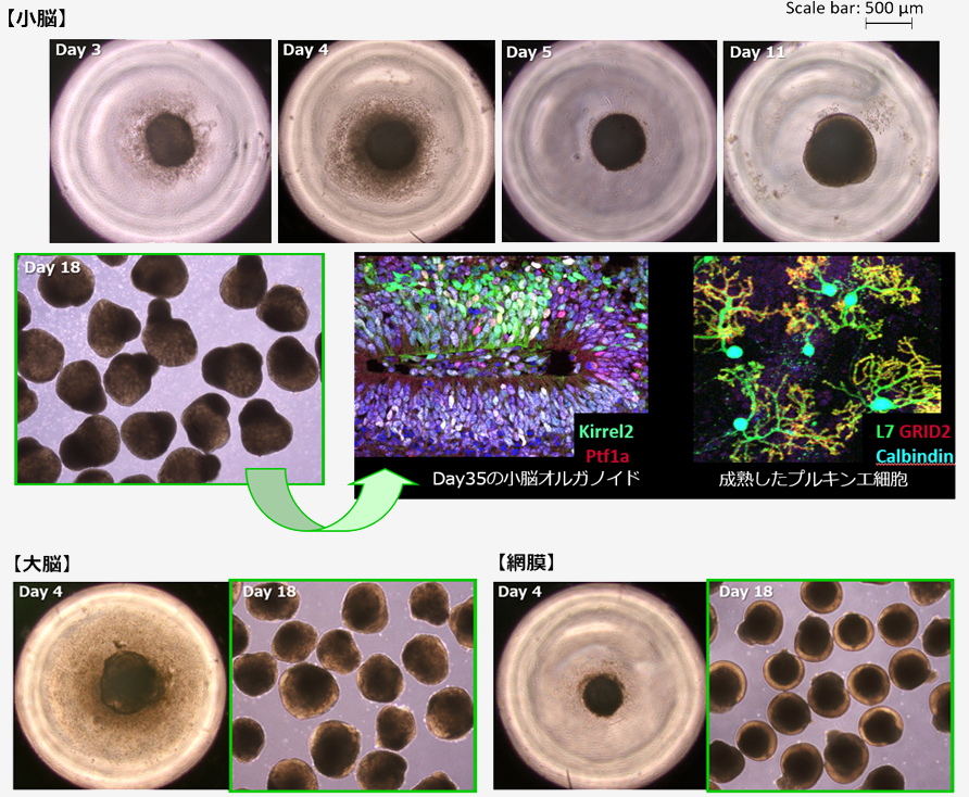 3D浮遊培養を用いたヒトiPS細胞から脳オルガノイドの作製