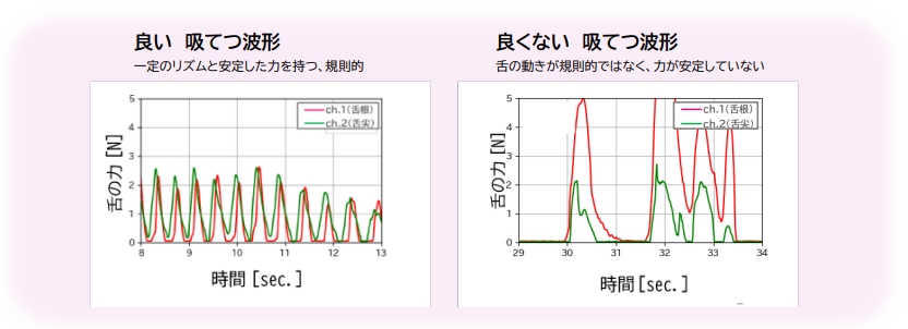 図:哺乳センシングデバイスを用いた計測結果